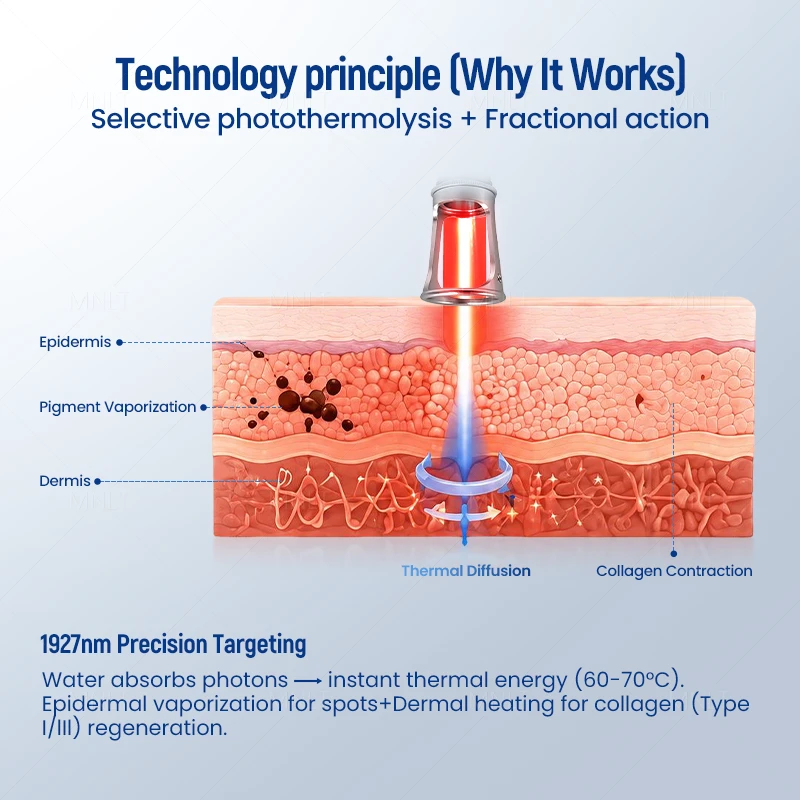 1927nm Thulium Laser Machine For Skin Resurfacing & Rejuvenation suppliers