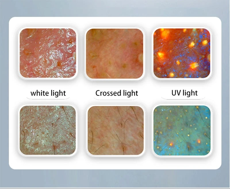 AI Skin Analyzer – Intelligent Skin Diagnostic System For Beauty Clinics & Aesthetic Centers price