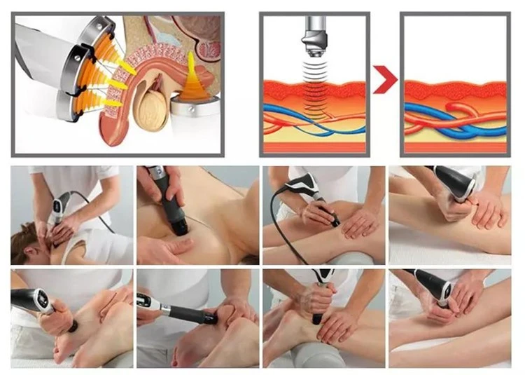 Effective Pain Relief Shockwave Machine